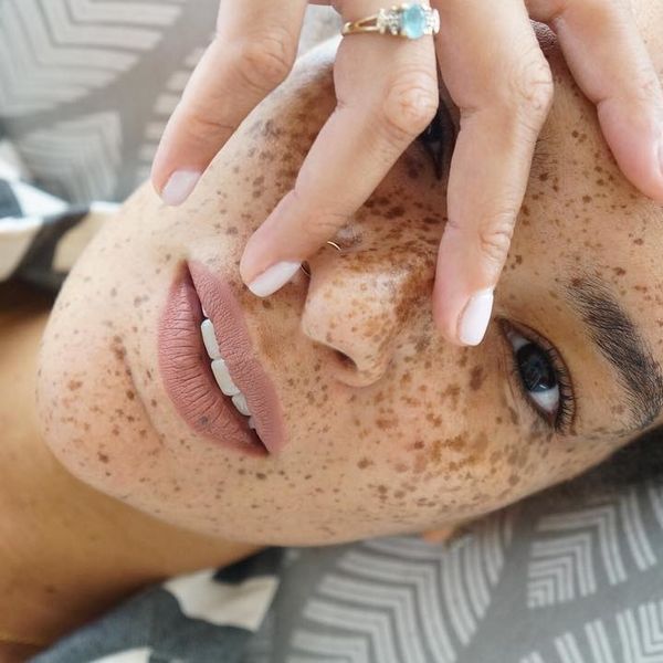 Model Nikia Phoenix: "Being A Freckled Face, Natural Haired Girl Isn't Easy"