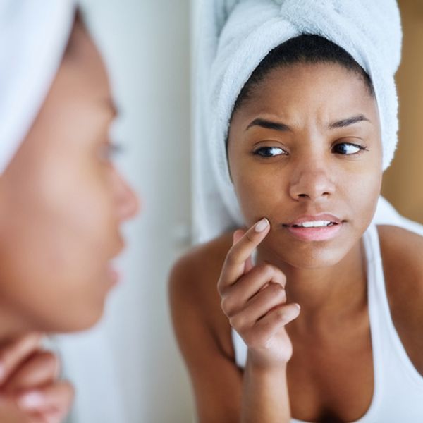 xoNecole Readers Share How They Get Rid Of Dark Spots