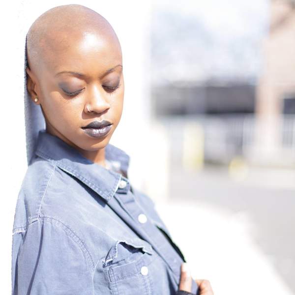 My Struggle With Alopecia: How I Learned To Find the Beauty In My Baldness