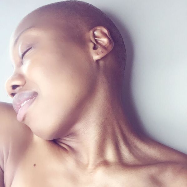Basking In My Baldness: How I Discovered Self-Love After Hair Loss