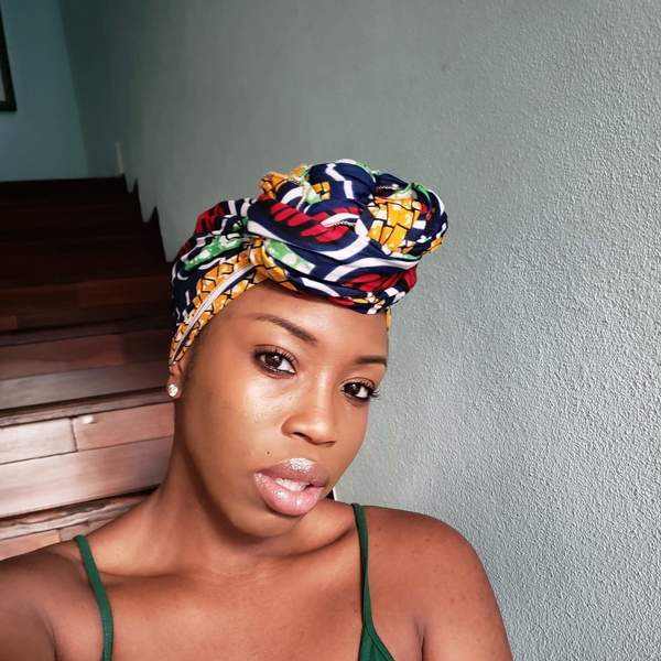 I Tried A Chemical Peel To Help Heal My Hyperpigmentation Woes