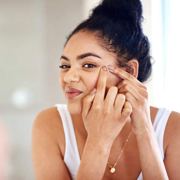 7 Natural Remedies For Hormonal Acne