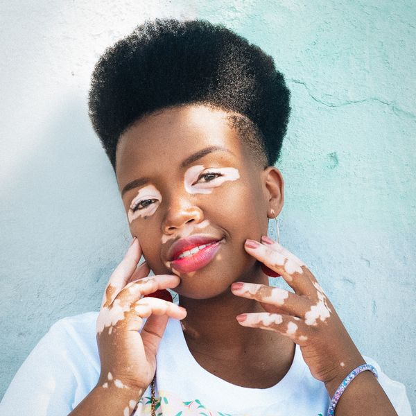 Dove's Project #SHOWUS Wants To Shatter Beauty Stereotypes One Photo At A Time