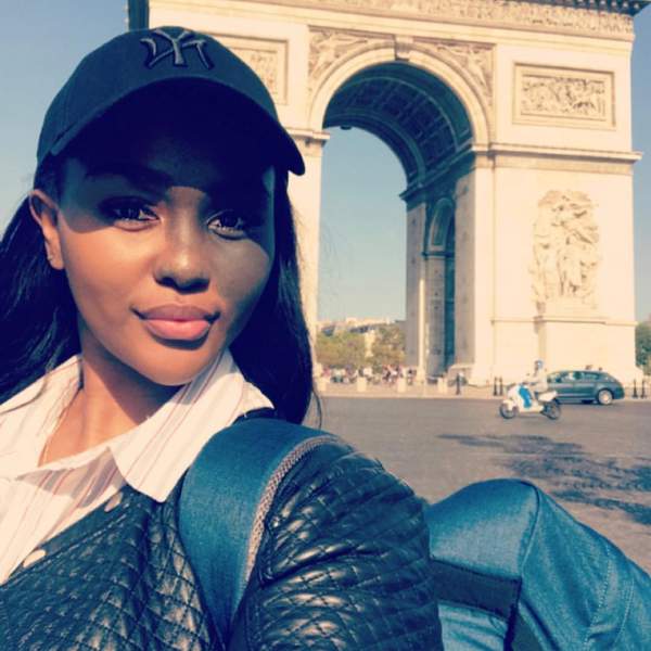 I Discovered My Beauty Through Loving A Birthmark I Hated