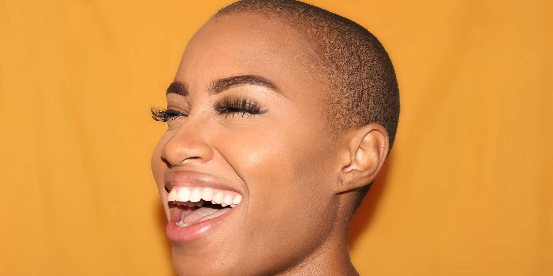 Here Are Some All-Natural Ways To Heal Acne Scars