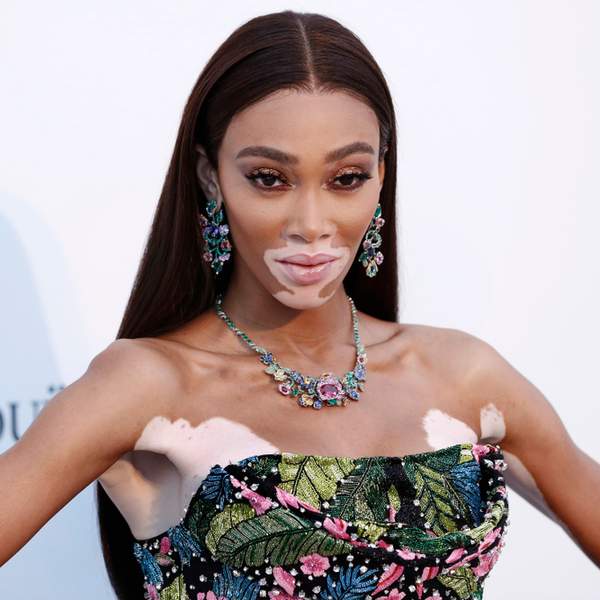 Winnie Harlow Gives Us The Details On How She Attained The Perfect Beat For Fashion Week