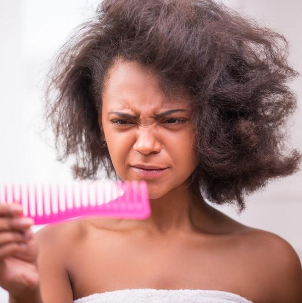 Stop Scratching: The Differences Between Dandruff And Dry Scalp