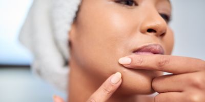 Woman-in-a-towel-using-her-fingers-to-pop-a-blind-pimple