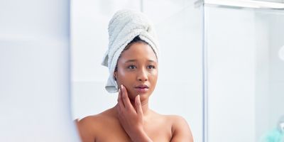 Signs-of-high-estrogen