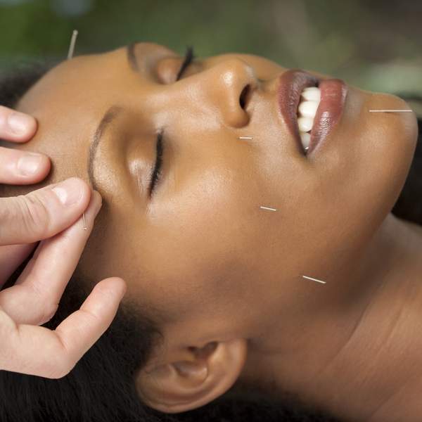 How Traditional Chinese Medicine Changed My Physical And Mental Health For The Better