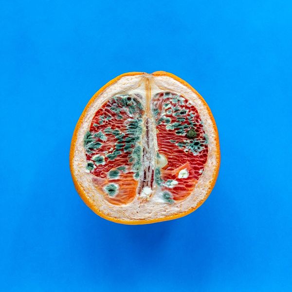 Do You Get More Yeast Infections In The Spring? There's A Reason For That.