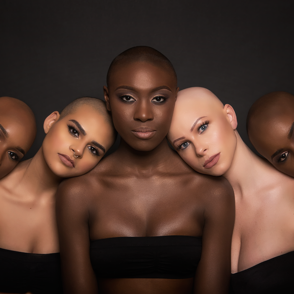 How Going Bald Inspired This Woman To Start A Baldie Movement