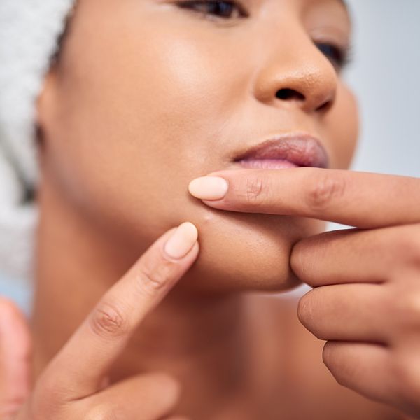 Woman-in-a-towel-using-her-fingers-to-pop-a-blind-pimple